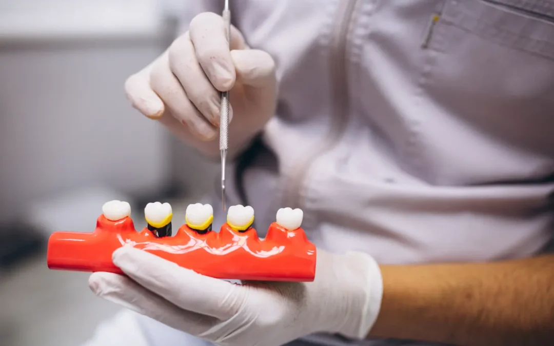 Diferencia entre corona y funda dental: ¿son lo mismo?