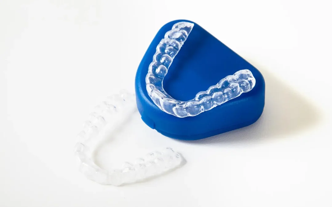 ¿Cuánto cuesta un Invisalign? Precios reales, tipos y qué incluye