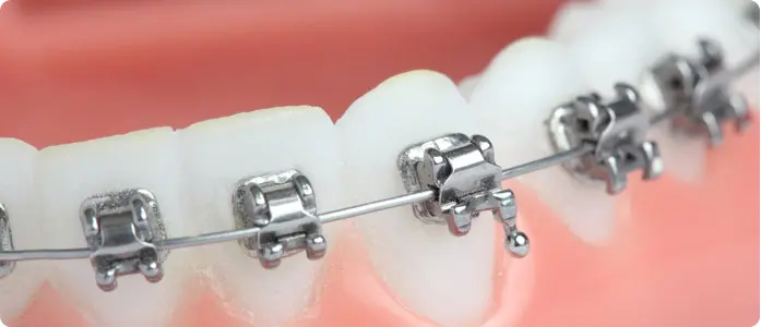 bracket con sistema de cierre